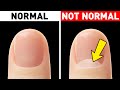 Look at Your Nails and You'll Realize How Rare Your Body Is