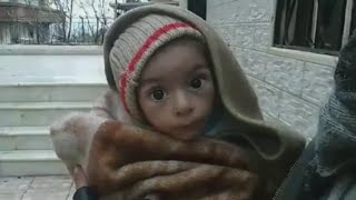 Madaya emergency: the starving Syrian children