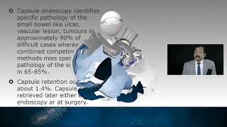 Learn Basics of Upper and Lower GI Endoscopy by Dr. R K Mishra
