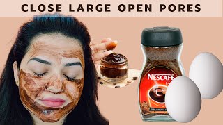 DIY Egg + Coffee Face Mask | Skin Whitening Face Pack - Close Large OPEN PORES \u0026 Remove Wrinkles