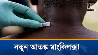 সম্প্রতি বিশ্বের ১২টি দেশে ছড়িয়েছে ভাইরাসজনিত বিরল রোগ মাংকিপক্স।