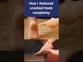 #shorts How I Reduced cracked Heels completely #viral #youtubeshorts #youtube #dryskin #rough