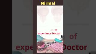 Enlarged Prostate surgery in Nirmal, Enlarged Prostate procedure in Nirmal