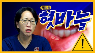 항암치료 중｜입안이 자꾸 헐어요 - [슬기엄마네 종양내과]