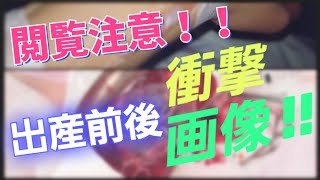 【出産前後】閲覧注意⚠ 滅多に見られない 衝撃画像 胎盤 グロ ＜2021年7月＞