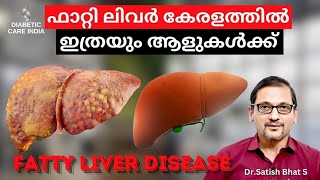 ഫാറ്റി ലിവർ കേരളത്തിൽ ഇത്രയും ആളുകൾക്ക് | Dr.Satish Bhat's | Diabetic Care India