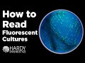 Candida + auris | How to Read Fluorescent Cultures | By Hardy Diagnostics