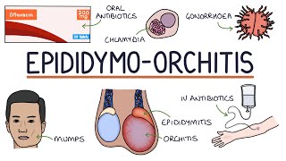 Understanding Epididymo-orchitis