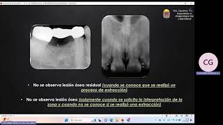 Sistemática de la Interpretación Radiográfica