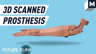 This Might Be the Most Customizable and Affordable Prosthetic Arm yet | Future Blink