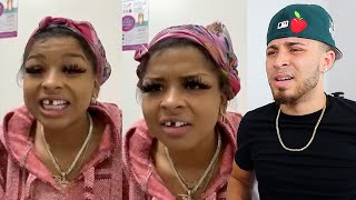 Toothless TH0T Says She Wants To F!GHT Adin Ross Next Time She Sees Him!! | REACTION