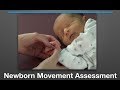 How to Evaluate Tyical and Atypical Baby Development with the Newborn Movement Assessment