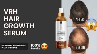 Introducing VRH Hair Growth Serum | Boost Hair Growth, Volume \u0026 Nourishes Scalp #vrh #haircare