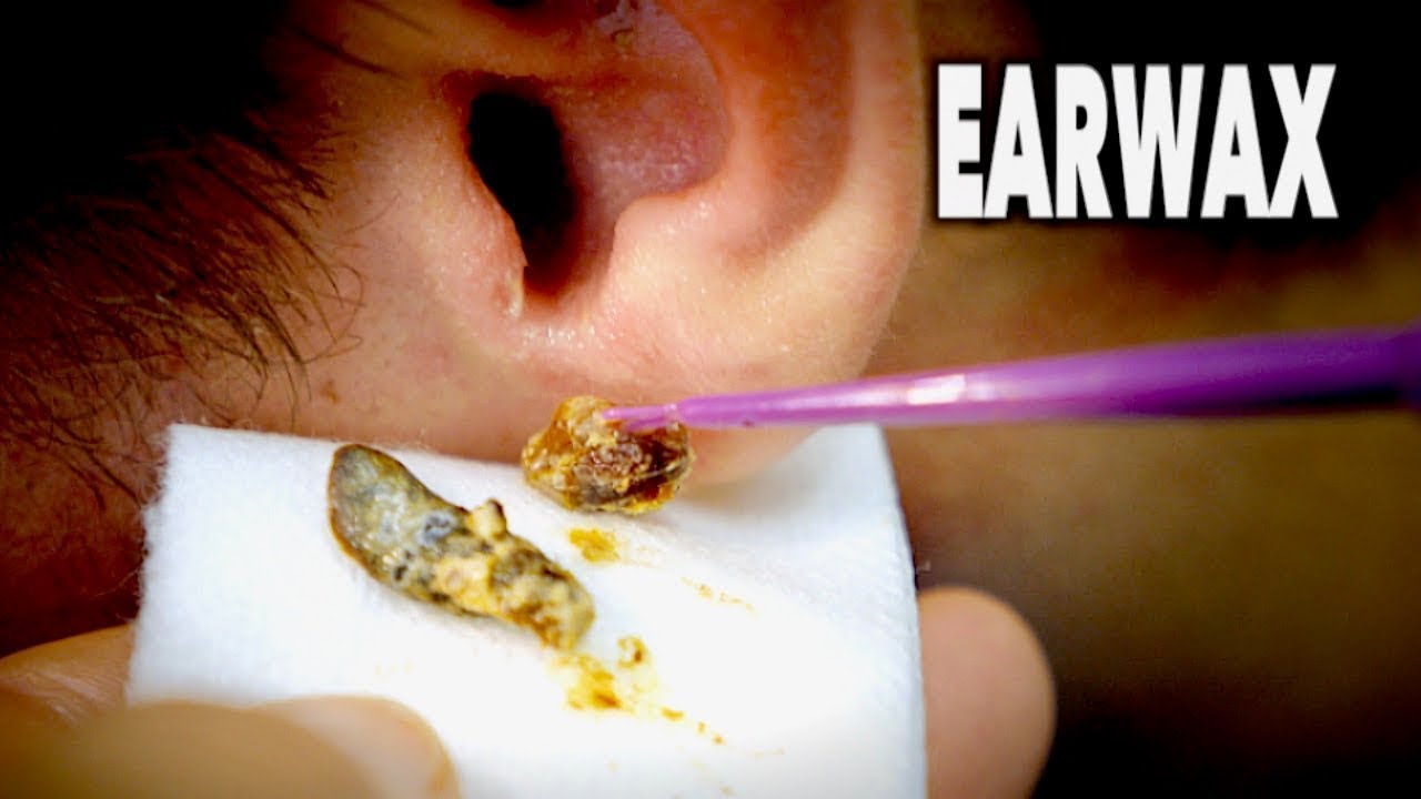 Ear Wax Cleaner - YouTube