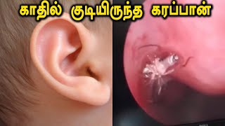 Cockroaches in ears:காதில் குடும்பத்துடன் குடியிருந்த கரப்பான் பூச்சி