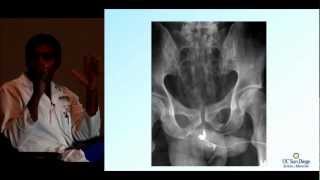 Trauma Day Away 2012 - Pelvic Fractures: A Complicated Injury by Vishal Bansal, MD, FACS