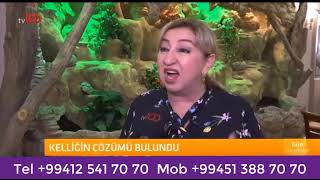 Tv 100  Dr. Məlahət Qəhrəmanova  Saç tökülməsi