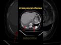 Gross plural effusion Ct Chest Radiology #shorts #ctscan #radiology