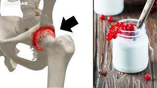 Natural remedies that restore HIP CARTILAGE