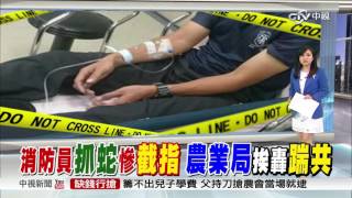 119隊員捕毒蛇遭咬 食指截肢保命│中視新聞 20160824