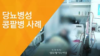 당뇨병성 콩팥병 사례 - (2017.6.21_625회 방송)_당뇨병, 식습관을 고쳐라