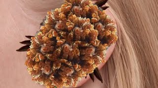 ASMR Animation Treatment Infected Ear ,, Treatment Ear 2D Collection || Deep Cleaning ASMR Animation