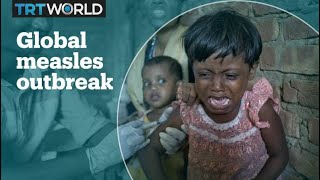 Measles outbreak spread globally, with vaccine scare blamed