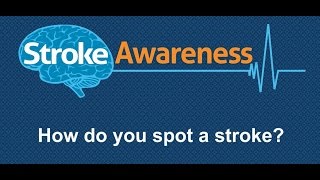 Stroke Awareness Video