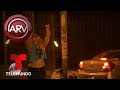 Jugar con fuego le dejó huellas en su cuerpo | Al Rojo Vivo | Telemundo