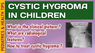 Cystic Hygroma | Symptoms, Diagnosis \u0026 Treatment