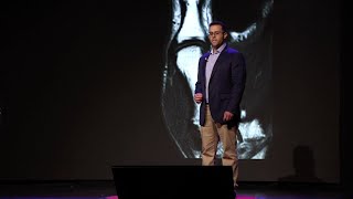 The next era of organ transplants | Nicholas Rinella | TEDxAmoskeagMillyard
