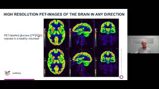 Medical imaging and (radio)chemistry