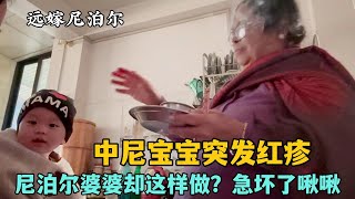 【JOJO的尼泊爾生活】混血寶寶突發紅疹，聽聽尼泊爾婆婆大姑姐咋說的？ 把啾啾給急壞了