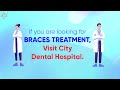 types of braces treatment for your oral betterment.