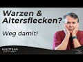 Entfernen von Warzen oder Altersflecken! - Dr. med. Klaus Hoffmann