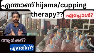 Hijama \u0026 Cupping Therapy for Skin/Smoking and complete body health/malayalam explanatio#abees uk #uk