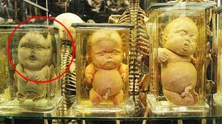 Top 10 Weird Medical Museums In The World || Pastimers