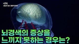 '뇌경색의 증상을 느끼지 못하는 경우는? | 경동맥 협착 | 뇌경색 | 명의 | #EBS건강