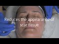 Timeless Beauty - Facial Treatment Promo Video