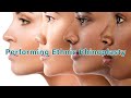 Performing Ethnic Rhinoplasty | Board Certified Facial Plastic Surgeon