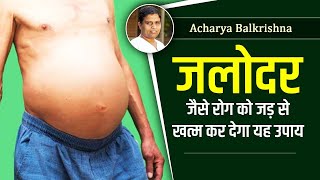 जलोदर (Ascites) जैसे रोग को जड़ से खत्म कर देगा यह उपाय || Acharya Balkrishna