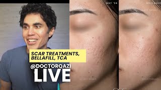 Dr. Qazi discusses Scar Treatments, Bellafill, Phenol Peels | Dr. Qazi Unsponsored Live | 2.12.2025