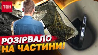 Телефон вибухнув у підлітка в руках - Луцьк на вухах