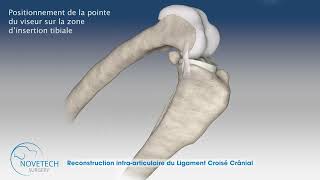 Reconstruction intra articulaire du Ligament Croisé Cranial avec NOVALIG®