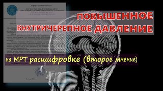 ПОВЫШЕННОЕ ВНУТРИЧЕРЕПНОЕ ДАВЛЕНИЕ у взрослых на расшифровке МРТ головного мозга (второе мнение)