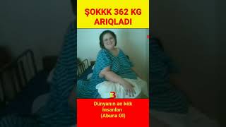 Dünyanın ən kök qadını. 362 kg arıqladı, görün nə hala düşdü şokkk. #shorts #short #kök #fat