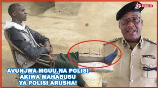 TUHUMA NZITO kwa KIGOGO wa POLISI ARUSHA AMVUNJA MAHABUSU MGUU kwa RUNGU SERO-JERAHA LAPAKWA CHUMVI