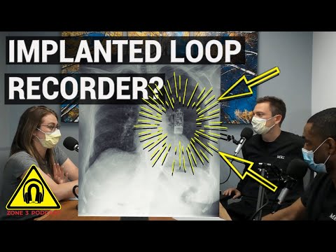 Can I have an MRI with a Linq monitor?