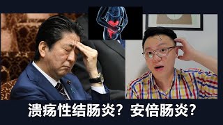 讓安倍晉三辭職的到底是什麼病？安倍腸炎？帶你認識潰瘍性結腸炎和炎症性腸病