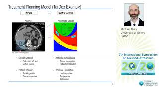 M. Gray - Planning \u0026 Delivery of Ultrasound-mediated Hyperthermia for Targeted Drug Delivery (2020)